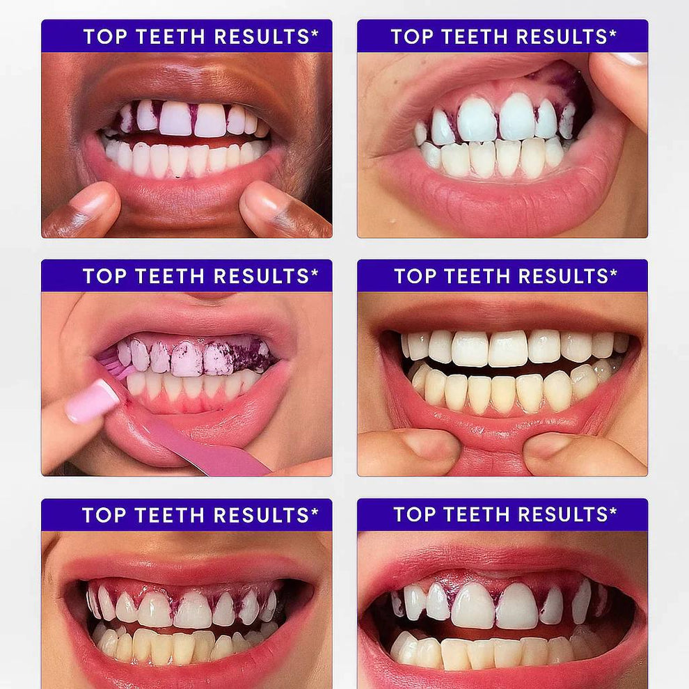 BBOJI™ Purple Teeth Whitening Strips