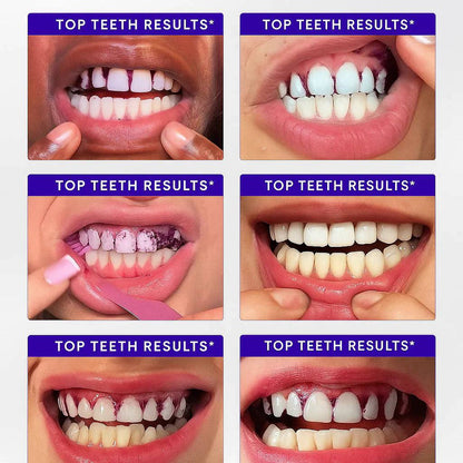BBOJI™ Purple Teeth Whitening Strips
