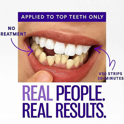 BBOJI™ Purple Teeth Whitening Strips