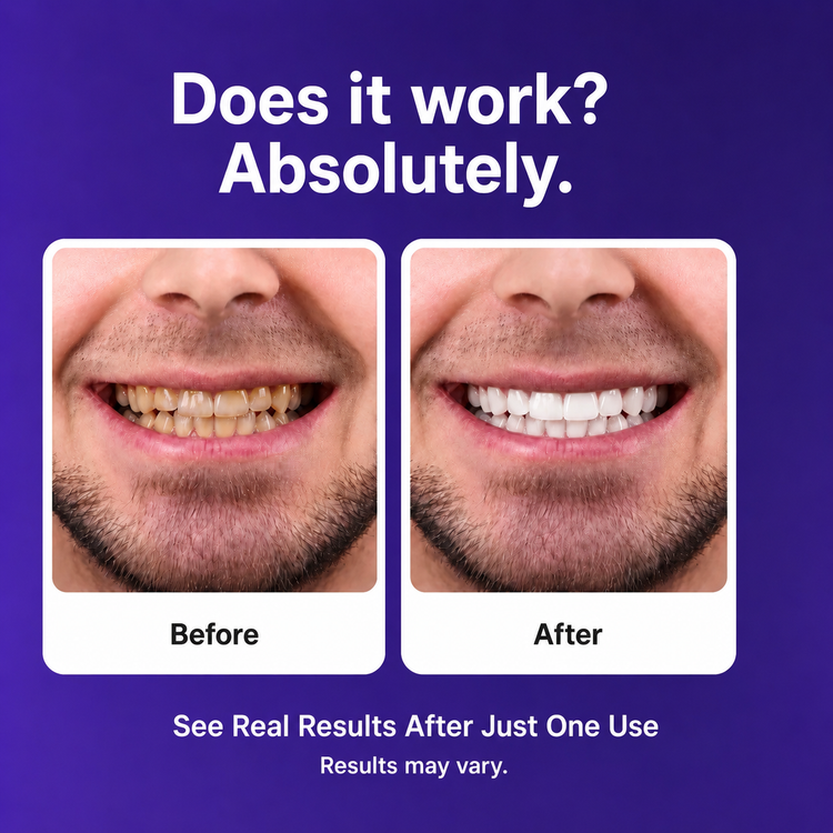 BBOJI™ Purple Teeth Whitening Strips